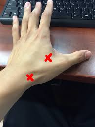 acupuncture point