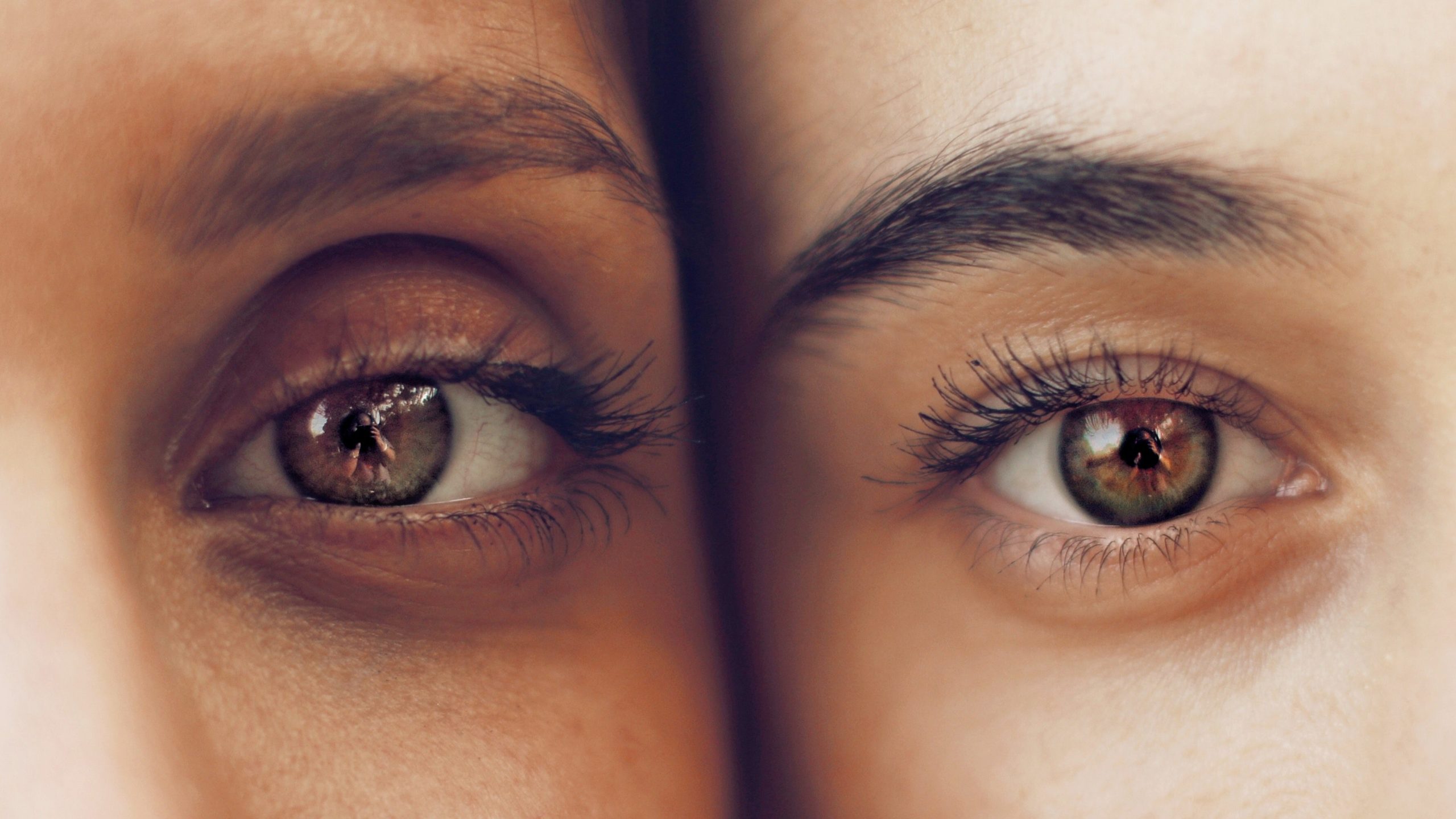 How to treat dark circles under the eyes