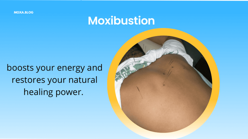 Moxibustion treatment