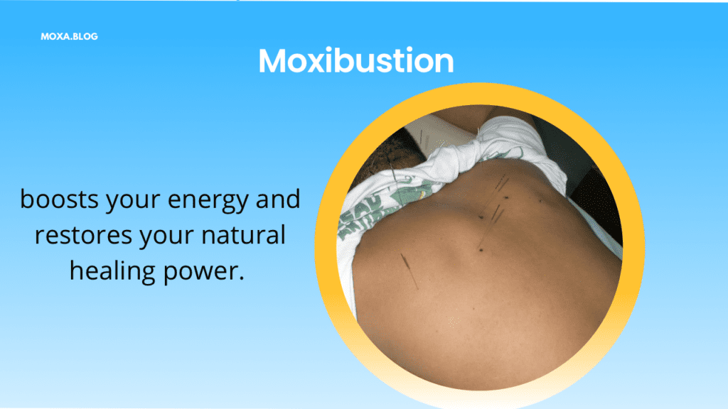 moxibustion