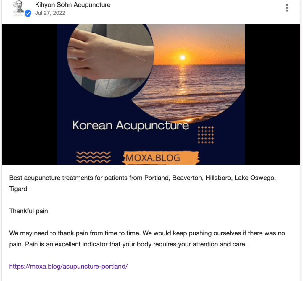 best acupuncture