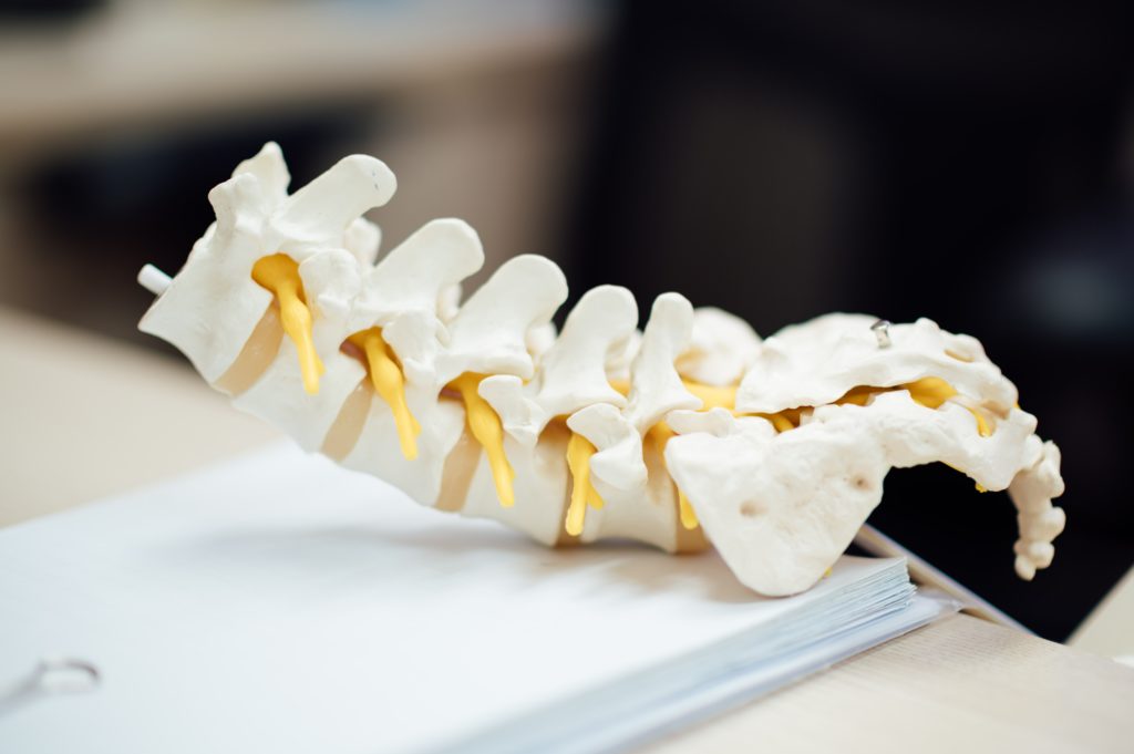 musculoskeletal disorder